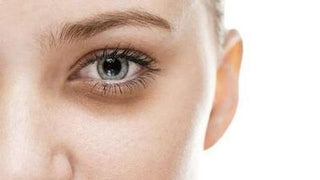 A New Perspective on Dark Circles: What You Should Really Know