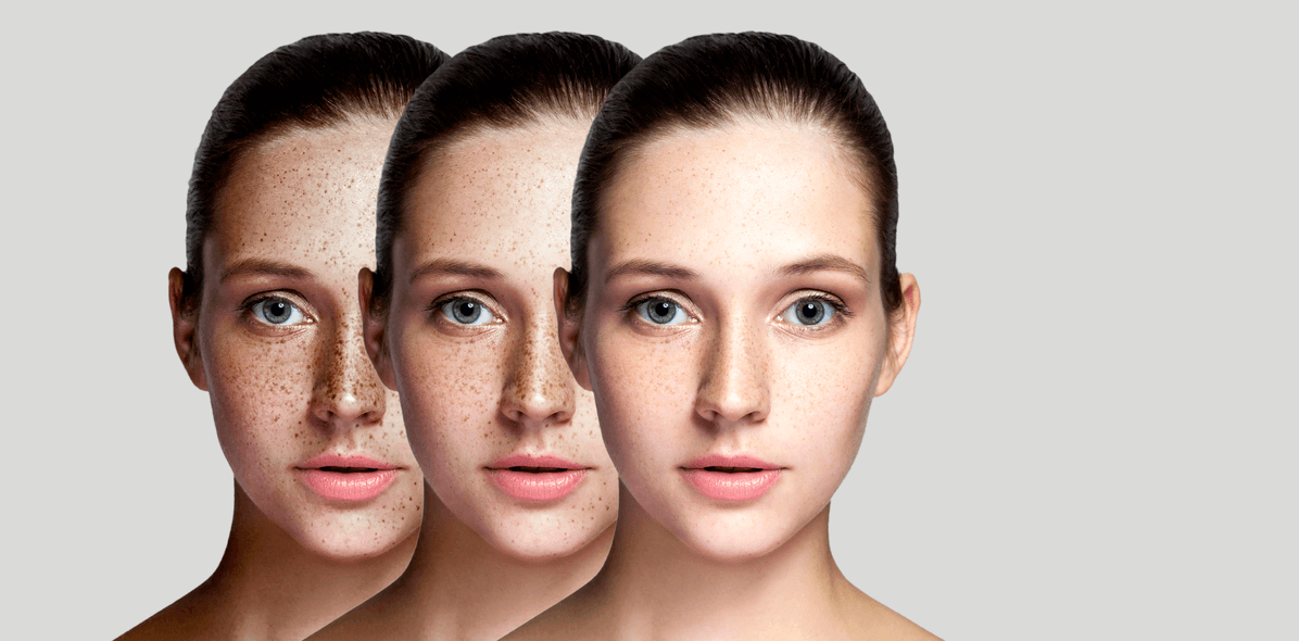 Scientific Blemish Reduction without Stepping On Mines