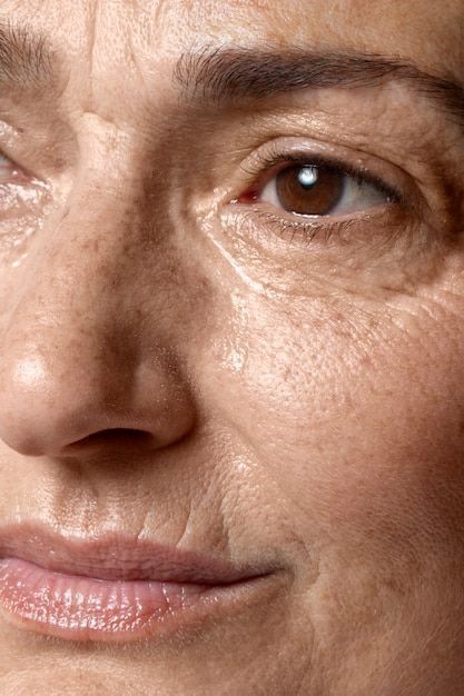 Fine Lines & Firmness