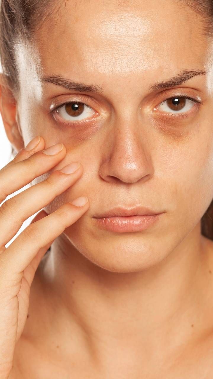 Tired-Looking Eyes