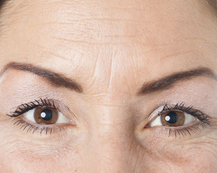 Fine Lines & Firmness