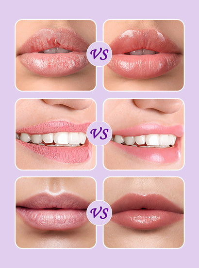 ANAIRUI Bakuchiol & Grape Lip Mask Set for Lip Treatment
