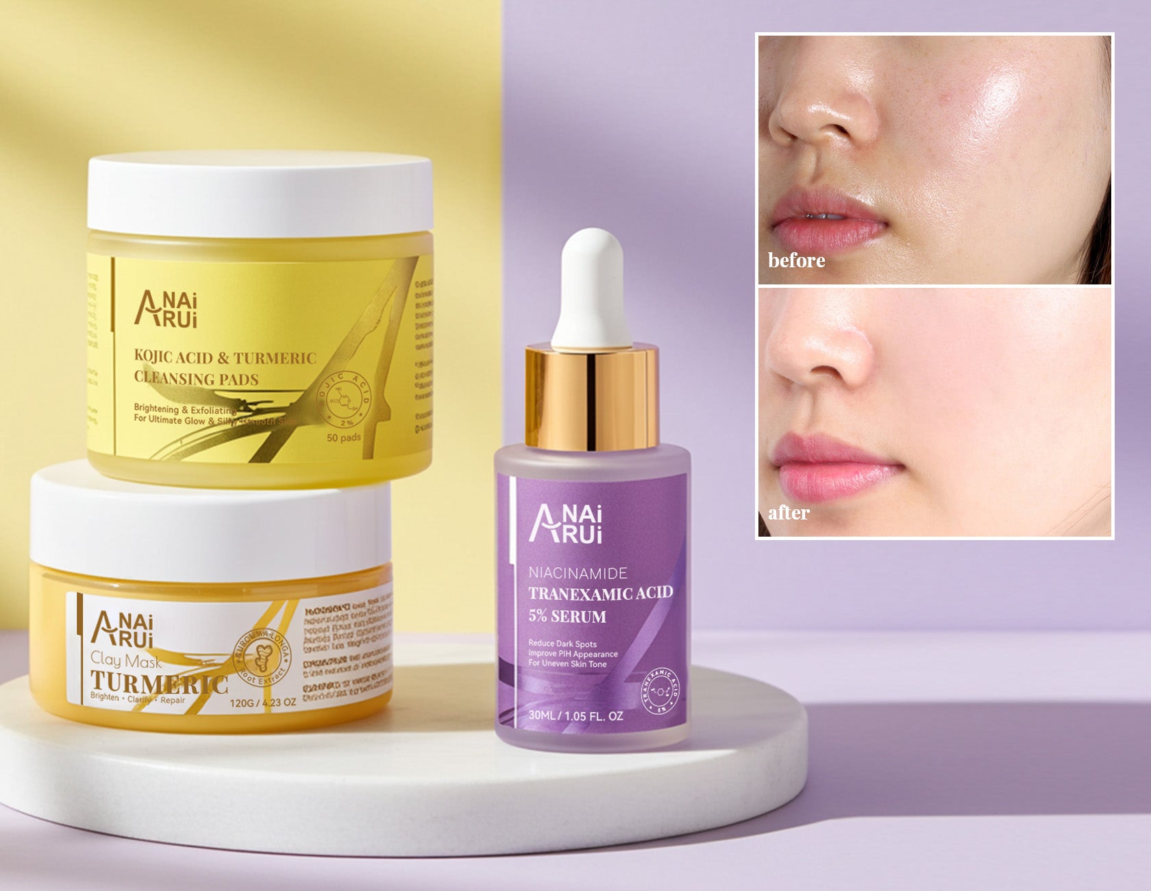 ANAIRUI Tranexamic Acid Spot-Fade Brightening Set