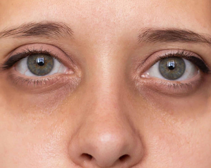 Tired-Looking Eyes
