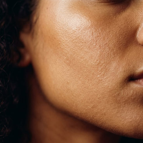 Dull Skin