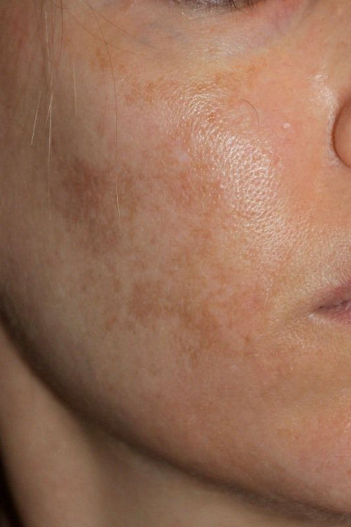 Dark Spot