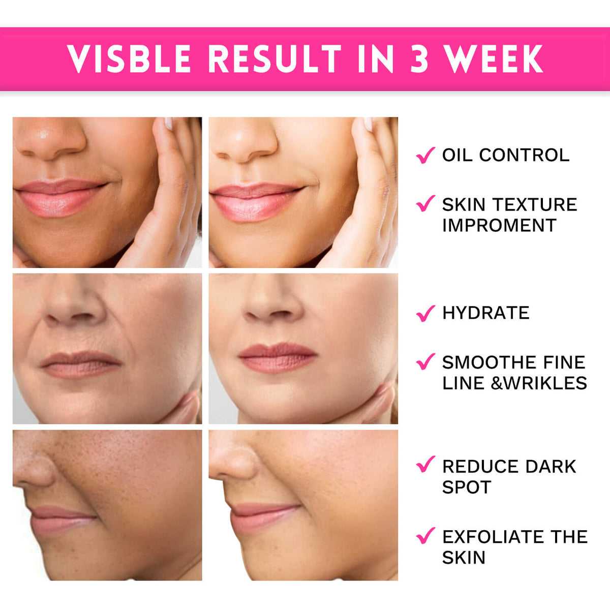  Glycolic Acid for Dark Spots